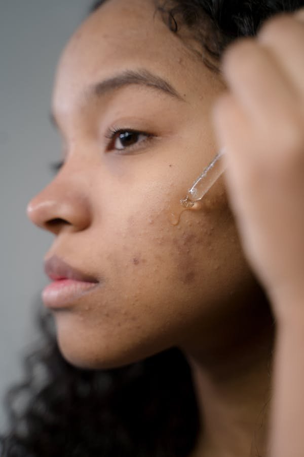 Acide salicylique : votre solution pour une peau revitalisée